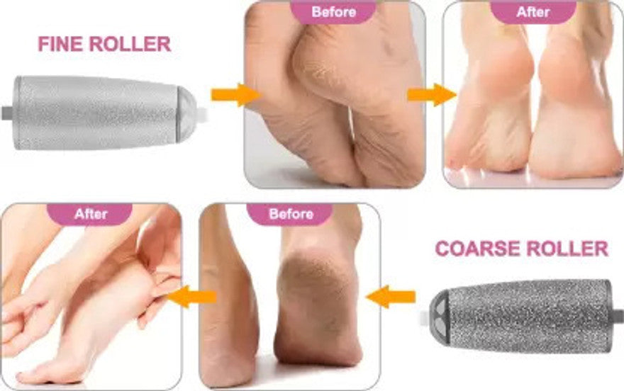 Foot Callus Remover for Dead Skin, Rechargeable Pedicure Device for Women Feet with 2 Roller Heads, Women Pedicure Kit for Feet